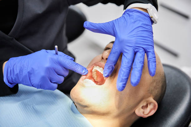 Best Mobile Emergency Dentist in Mayfair, CA
