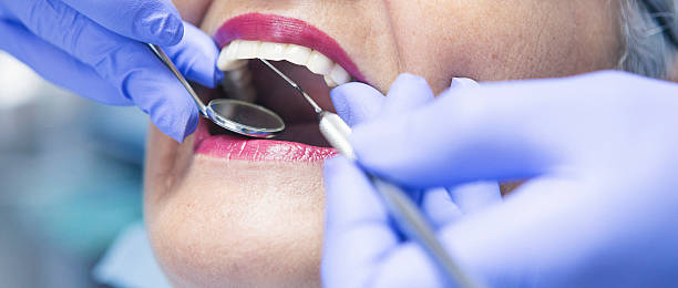 Best Urgent Dental Care for Toothache in Mayfair, CA